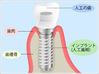 鈴木一成